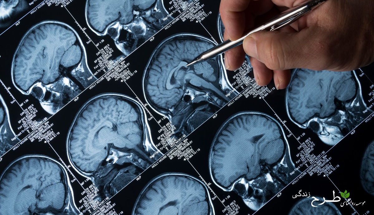 دلایل شناختی و عصبی خطای شناختی فاجعهسازی