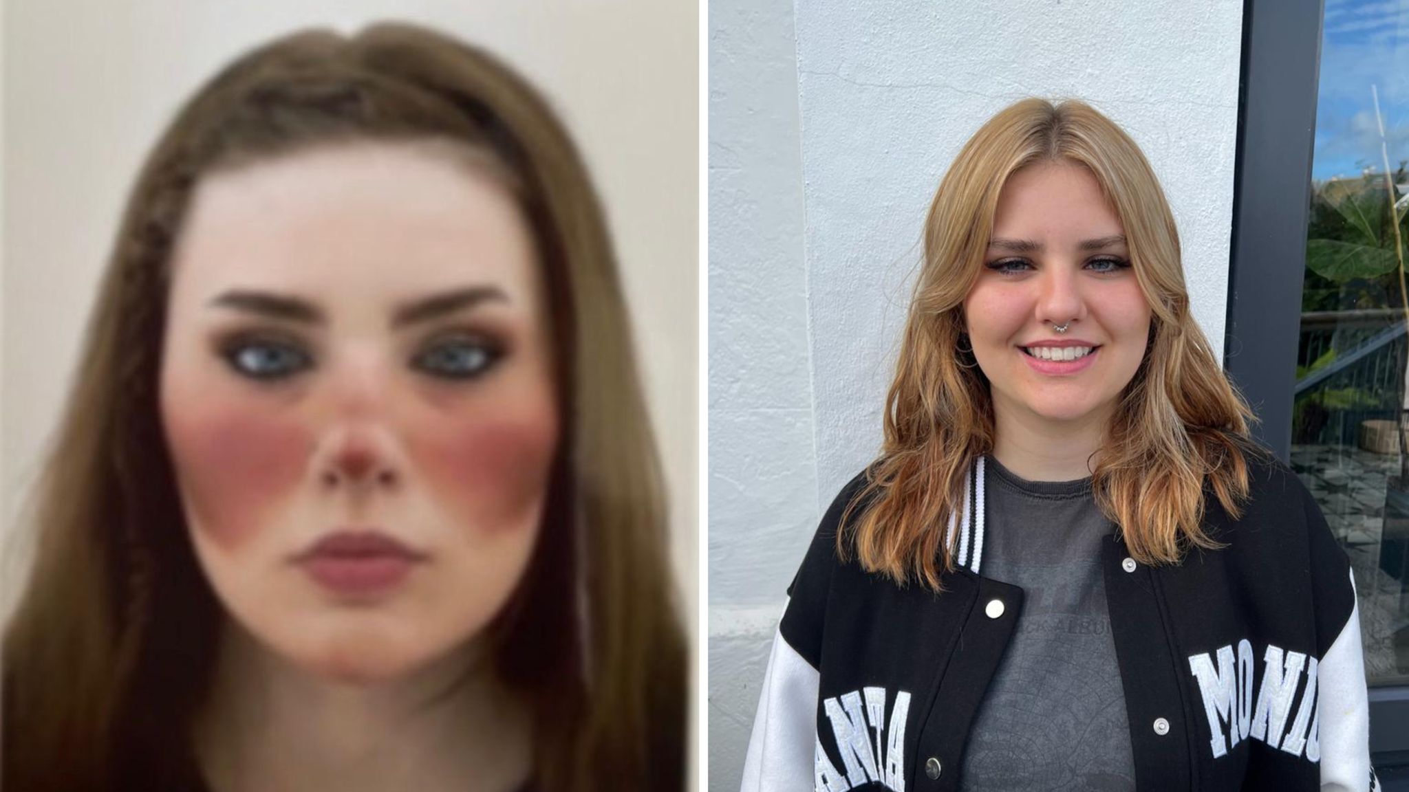 بدریختانگاری بدن عکسی از خانمی که بدلیل بدریخت انگای صورت خود را تغییر داده